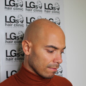 natural hairline tattoo birmingham natural hairline tattoo birmingham