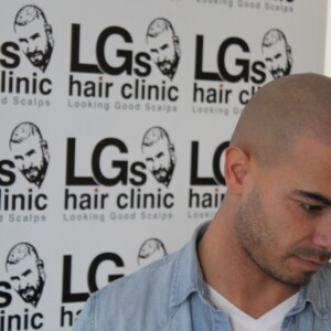 head tattoo harley street head tattoo harley street