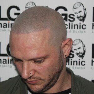 tattooed hairline tattooed hairline