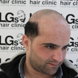 tattoo hairline tattoo hairline