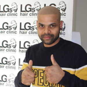 scalp hair tattoo hair loss scalp hair tattoo hair loss