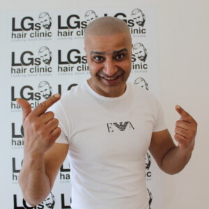 reduce pattern baldness reduce pattern baldness