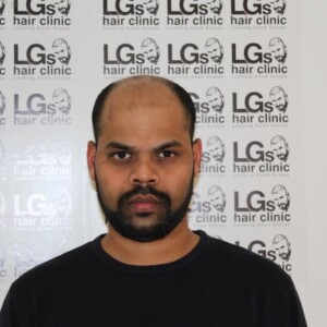 tattoo hairline birmingham tattoo hairline birmingham