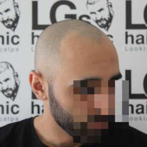 hairline tattoo service hairline tattoo service