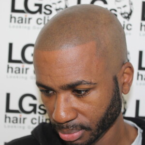 natural hairline tattoo natural hairline tattoo