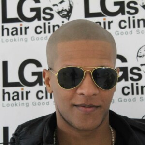 alopecia areata treatment cost alopecia areata treatment cost