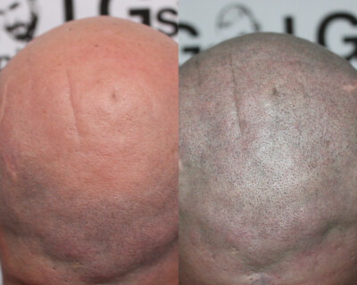 Hair tattoo Hair tattoo