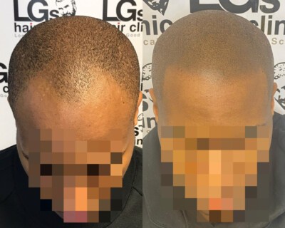 Hair tattoo Hair tattoo