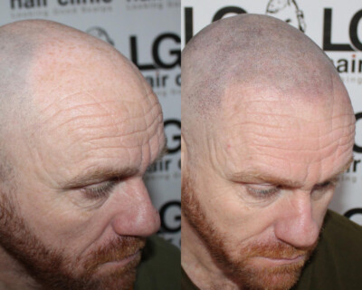 Hair tattoo Hair tattoo