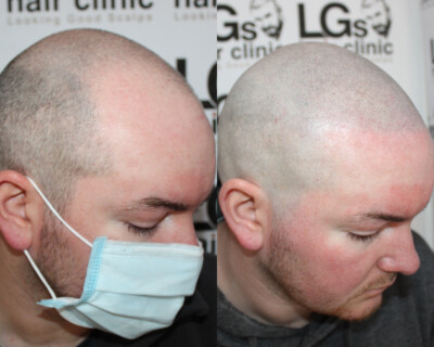 Hair tattoo Hair tattoo