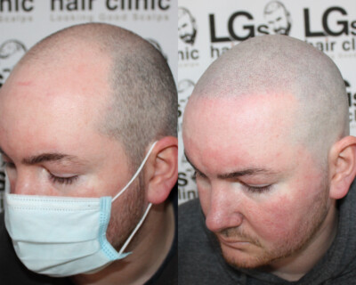 Hair tattoo Hair tattoo