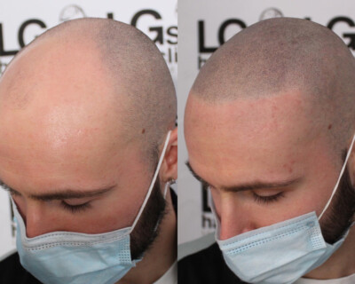 Hair tattoo Hair tattoo