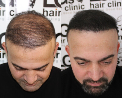 Hair tattoo Hair tattoo