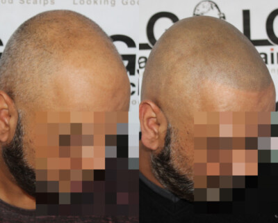 Hair tattoo Hair tattoo