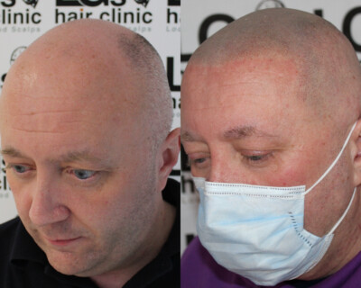 Hair tattoo Hair tattoo