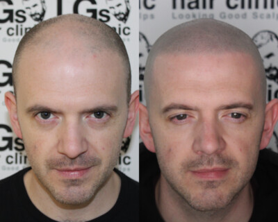 Hair tattoo Hair tattoo