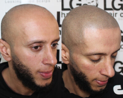 Hair tattooing Hair tattoo