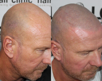 Hair tattoo Hair tattoo