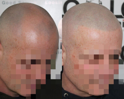 Hair tattoo Hair tattoo