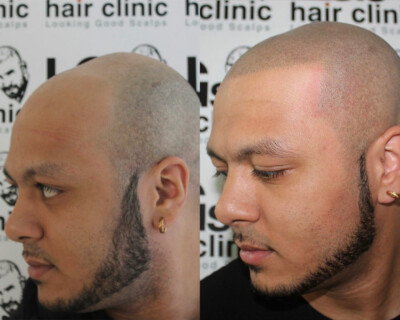 tattoo hairline tattoo hairline