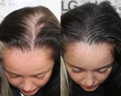 womens hairline tattoo womens hairline tattoo