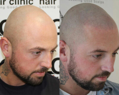 hair tattoo birmingham hair tattoo birmingham