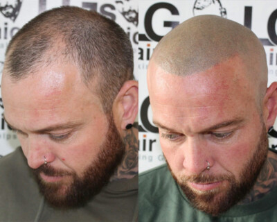 best mens hairline tattoo birmingham best mens hairline tattoo birmingham