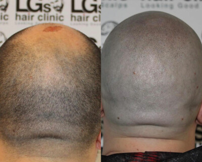 hair tattooing price hair tattooing price