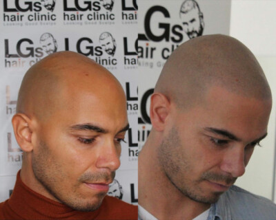 smp clinic birmingham smp clinic birmingham